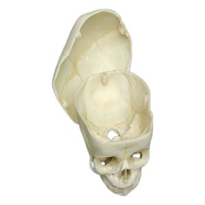 Human skull of 40 weeks - with calvarium cut